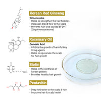 Hair Fall Treatment Kit For Dandruff- Alopex Penta Shampoo, Scalp Care Solution, Fights Dandruff & Itchiness, New Hair Growth - Keya Seth Aromatherapy