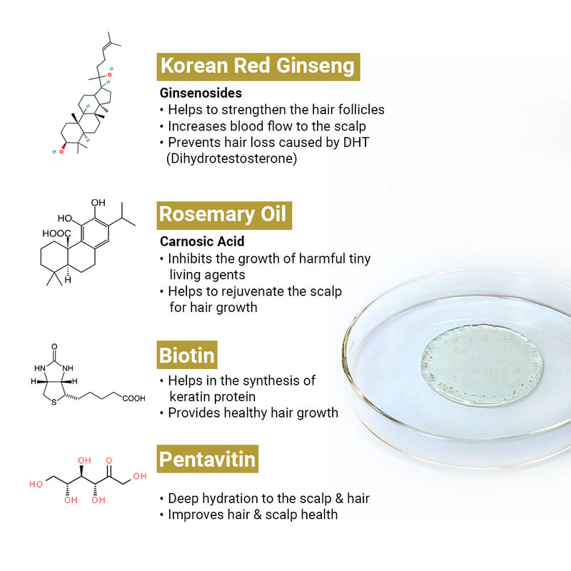 Complete Treatment Kit For Acute Hair Fall - Absolute Solution, Scalp Care, Alopex shampoo, Blocks hair fall & Fights Dandruff & Itchiness, New Hair Growth - Keya Seth Aromatherapy