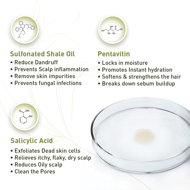 Hair Fall Treatment Kit For Dandruff- Alopex Penta Shampoo, Scalp Care Solution, Fights Dandruff & Itchiness, New Hair Growth - Keya Seth Aromatherapy